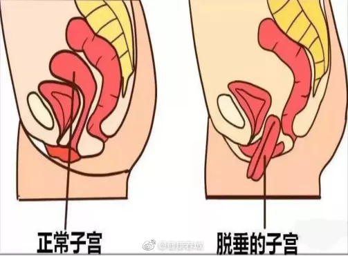 “健康春城”微博