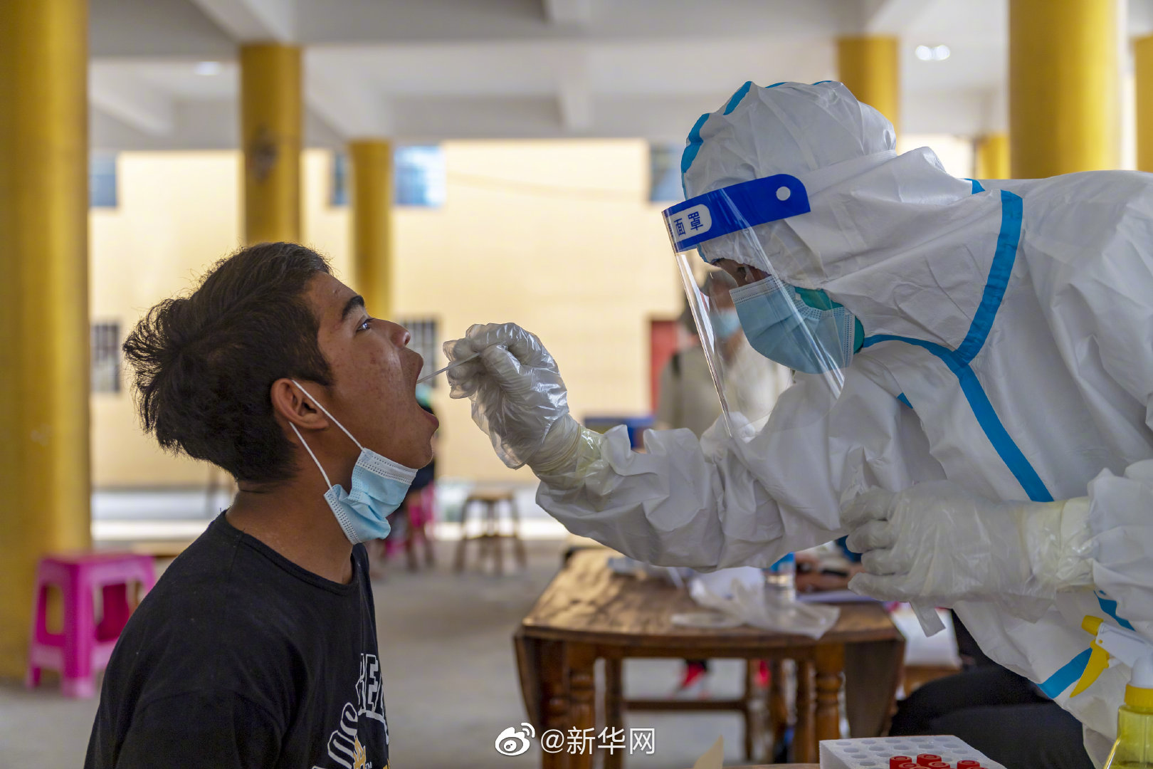 云南瑞丽:定点医院收治病例病情平稳 无重症及死亡病例