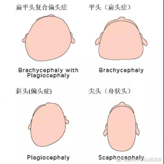 “昆明市西山区发布”微博