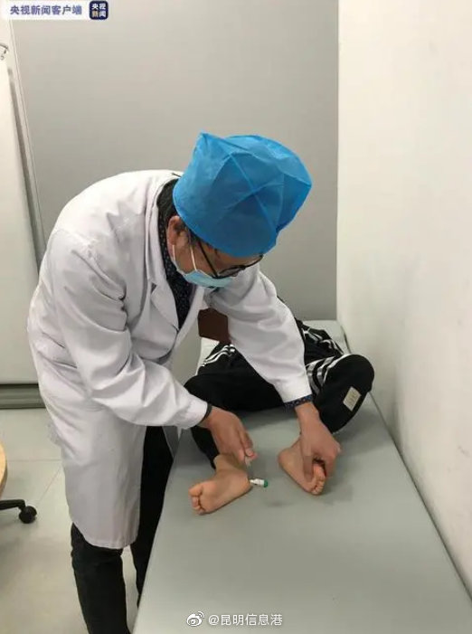 云南11岁男孩脑部感染寄生虫