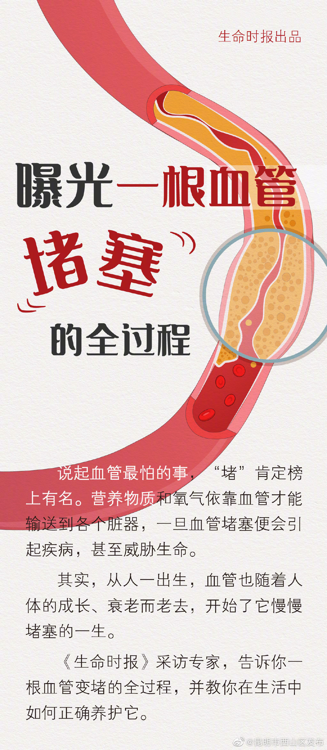 “昆明市西山区发布”微博