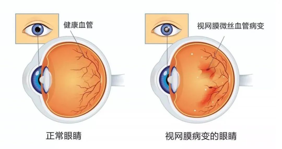 春城晚报(微信)