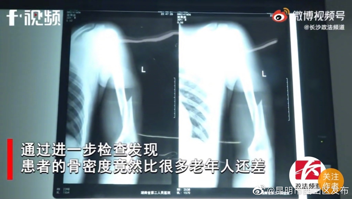 “昆明市西山区发布”微博