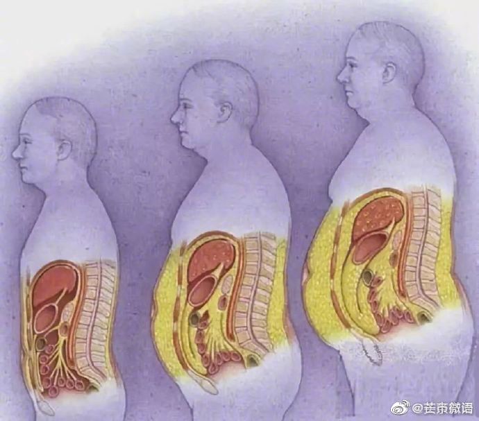 约两成癌症由肥胖引起 减肥不能只是随口说说