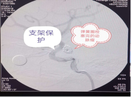 蒙自市人民医院快讯