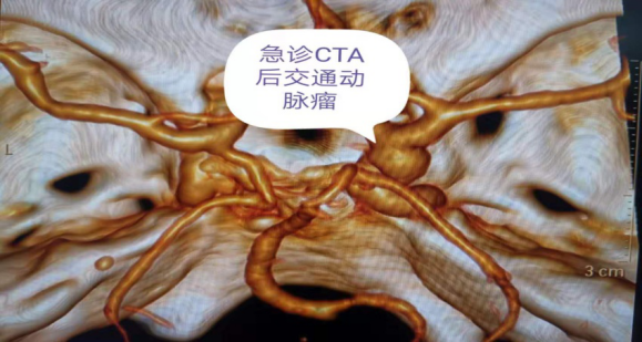 蒙自市人民医院快讯