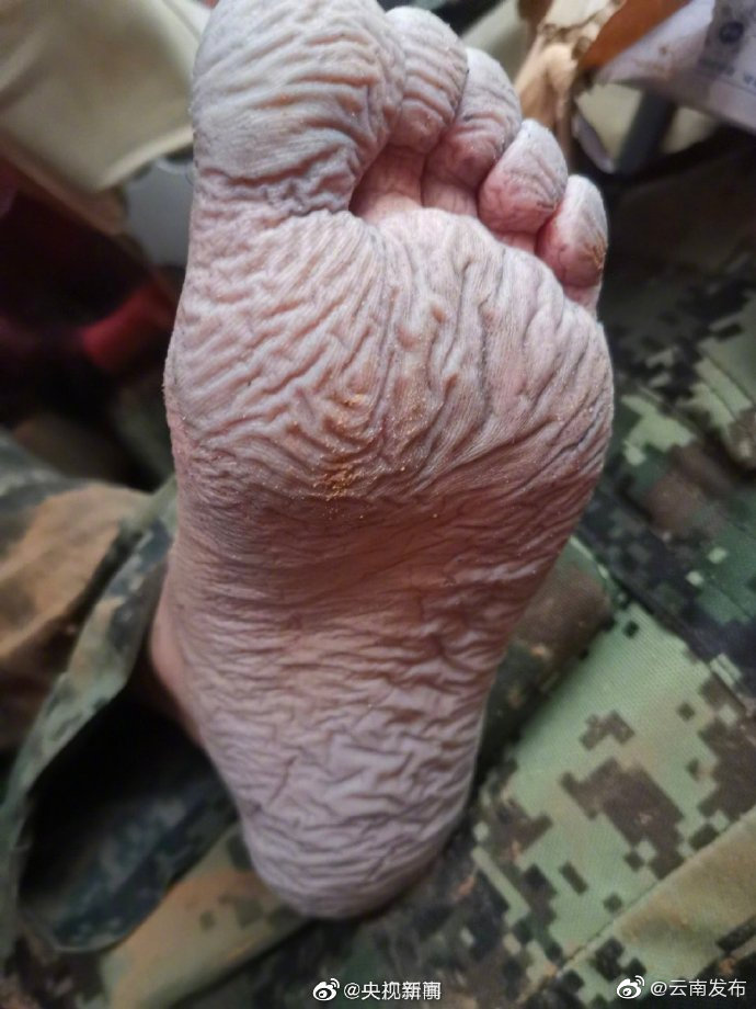 “云南发布”微博