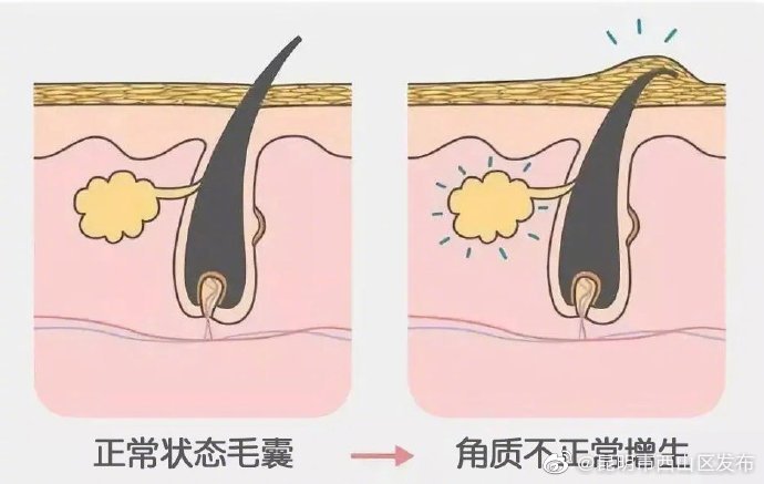 “昆明市西山区发布”微博