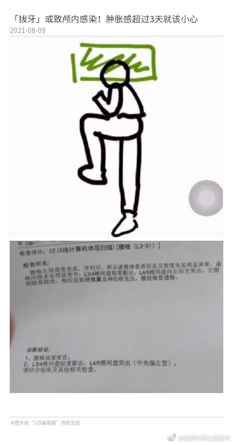 “昆明市西山区发布”微博