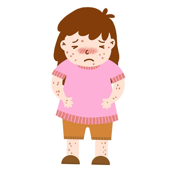 光靠祛湿健脾能治特应性皮炎吗？三种“配方”请查收！