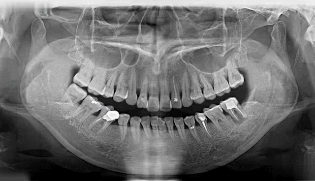 掌上春城(微信)