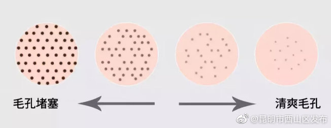 “昆明市西山区发布”微博