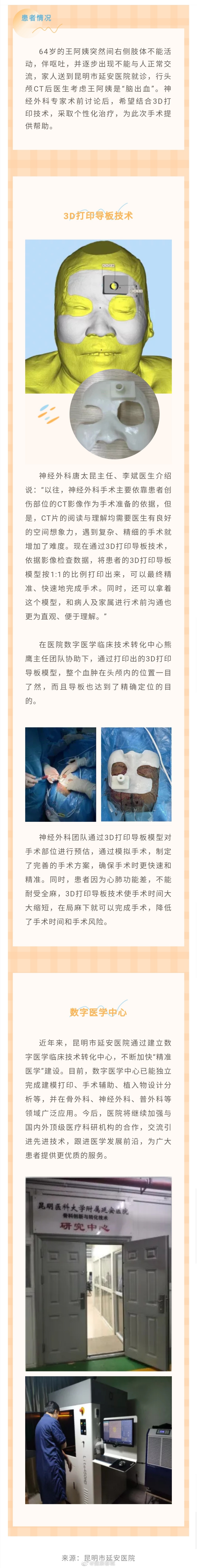 昆明市延安医院以3D打印技术助力神经外科手术