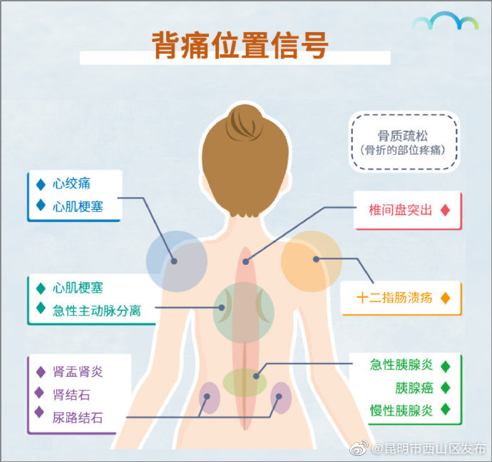 一张「疼痛位置图解」，帮你记住背痛原因