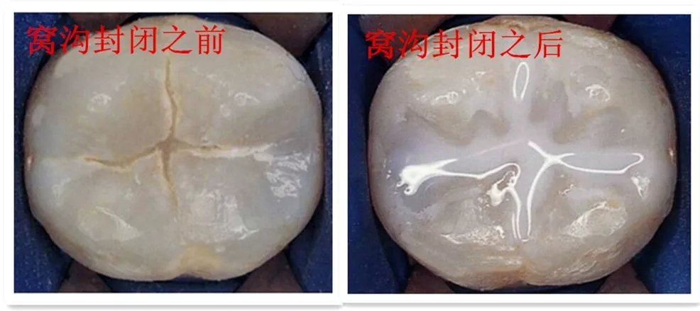 思茅区人民医院