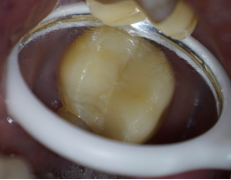 春城晚报(微信)