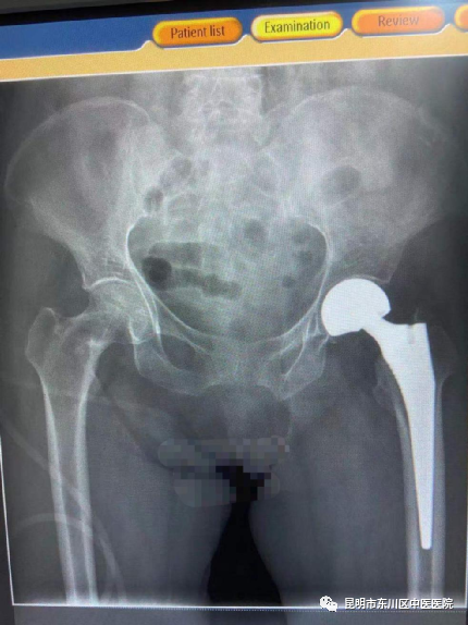 昆明市东川区中医医院