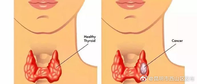 “昆明市西山区发布”微博