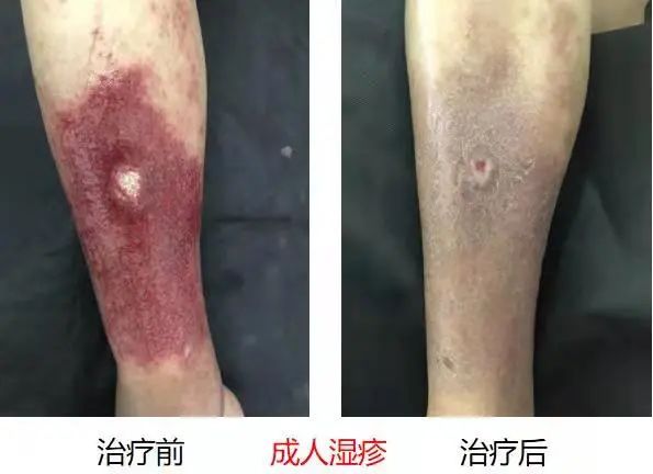 思茅区人民医院