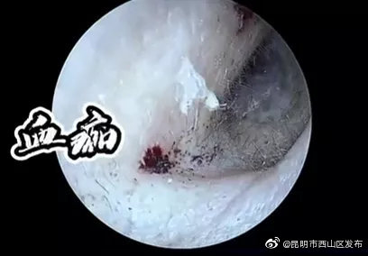 “昆明市西山区发布”微博