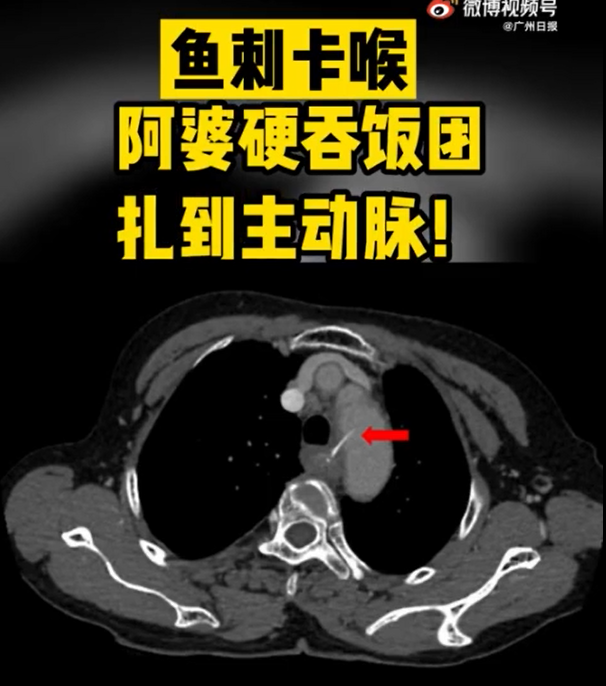 春城晚报(微信)