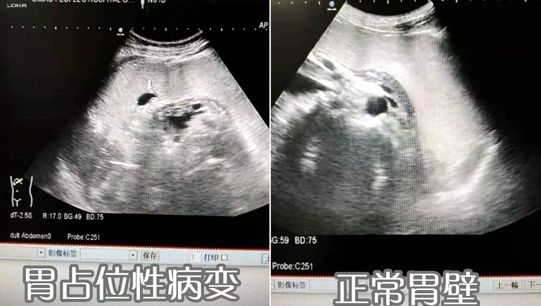 思茅区人民医院