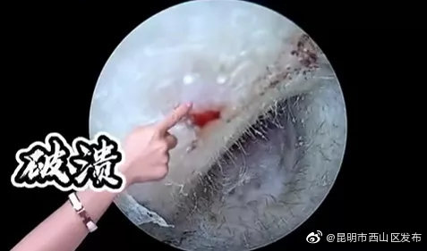 “昆明市西山区发布”微博