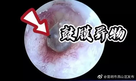 “昆明市西山区发布”微博