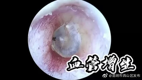 “昆明市西山区发布”微博