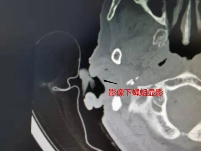 春城晚报(微信)
