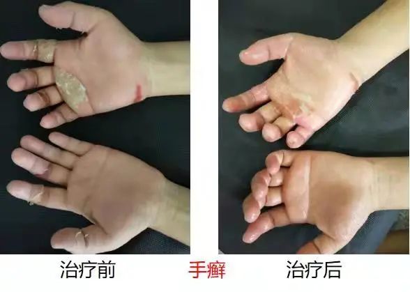 思茅区人民医院