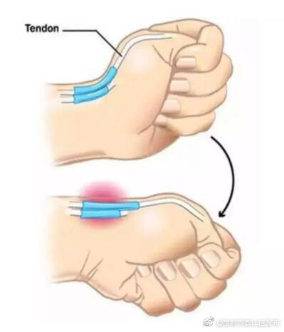 “昆明市西山区发布”微博