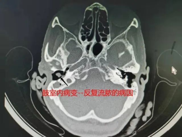 春城晚报(微信)