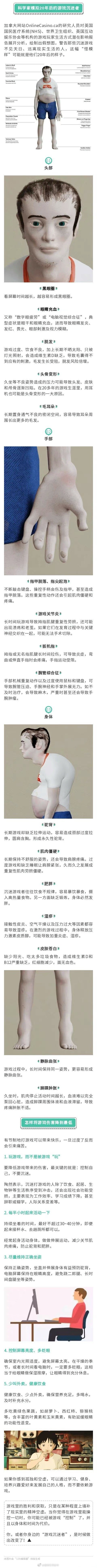 长期打游戏会变丑 还影响大脑结构