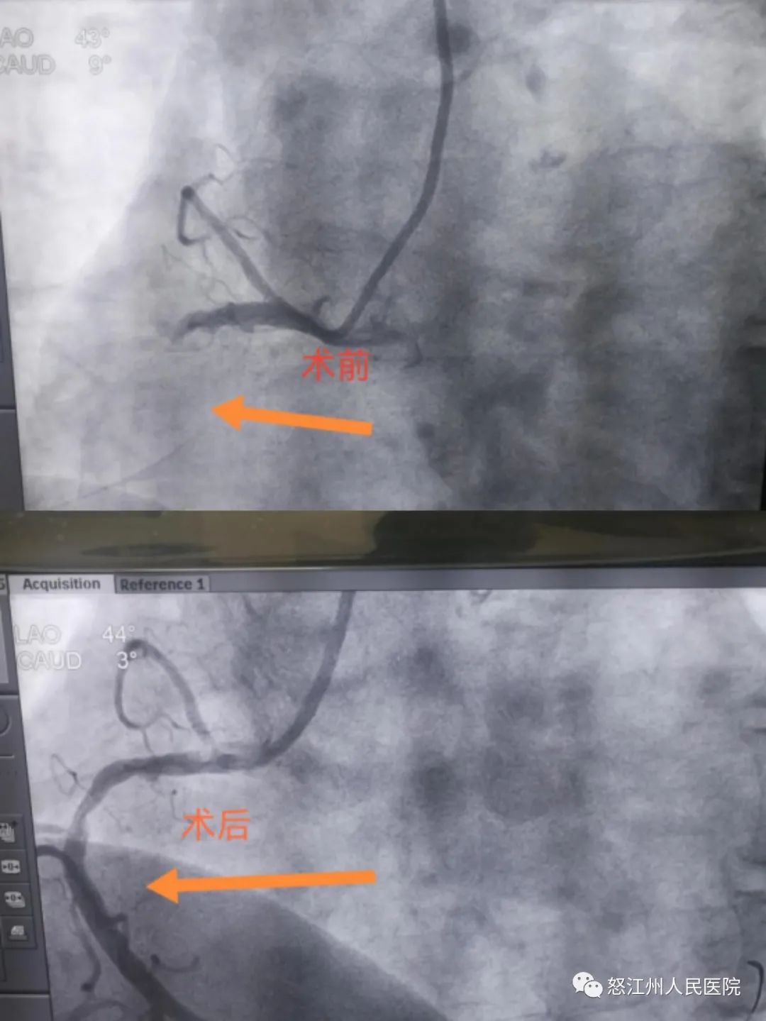 怒江州人民医院