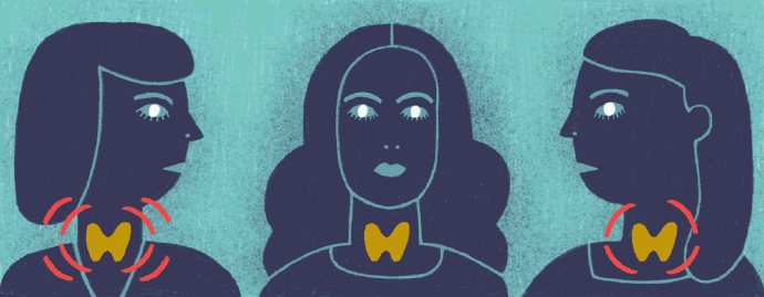 老犯困可能是甲状腺病了