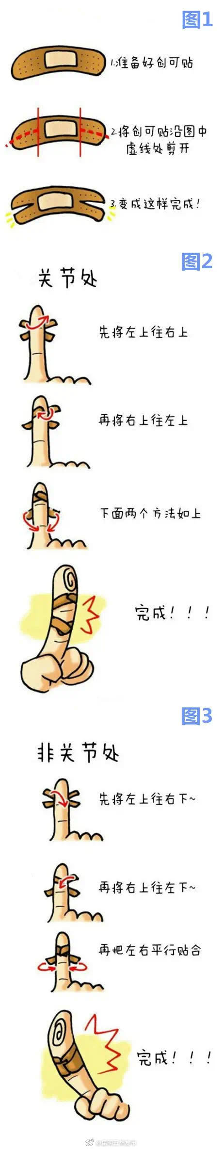 七种情况不能用创可贴，错误包扎可能让手指坏死