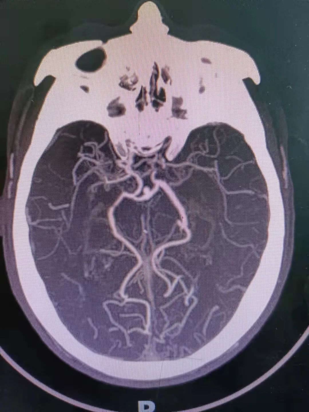 西双版纳傣族自治州人民医院