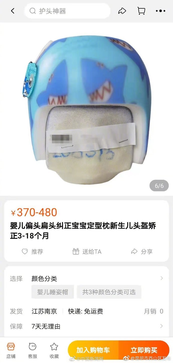 医生称矫正头盔或影响婴儿大脑发育