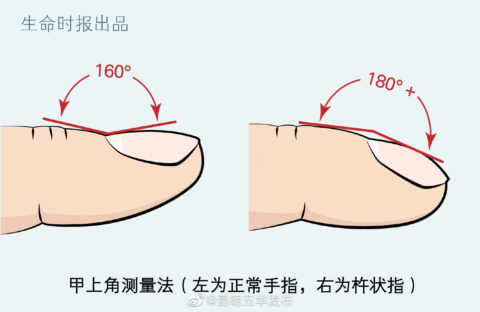“昆明五华发布”微博