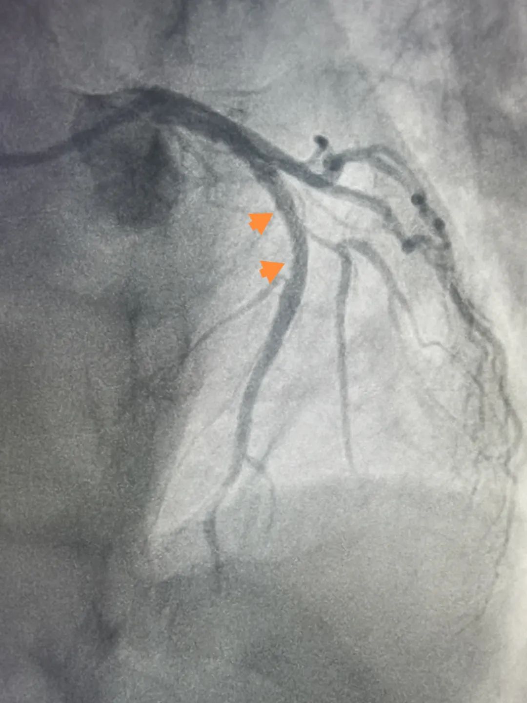 普洱市人民医院