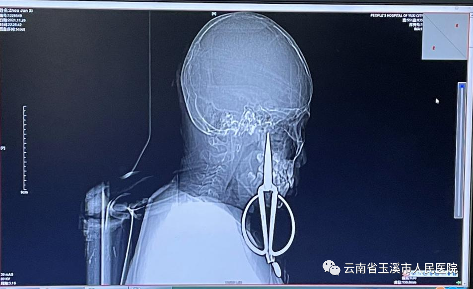云南省玉溪市人民医院