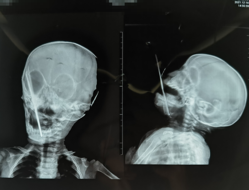 昆明医科大学附属口腔医院