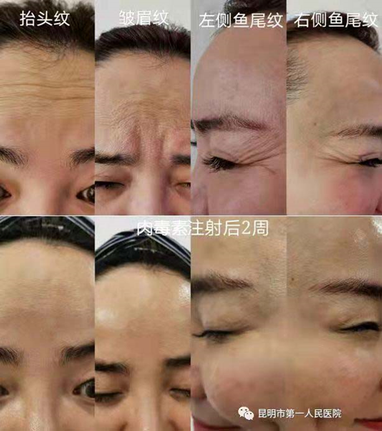 昆明市第一人民医院