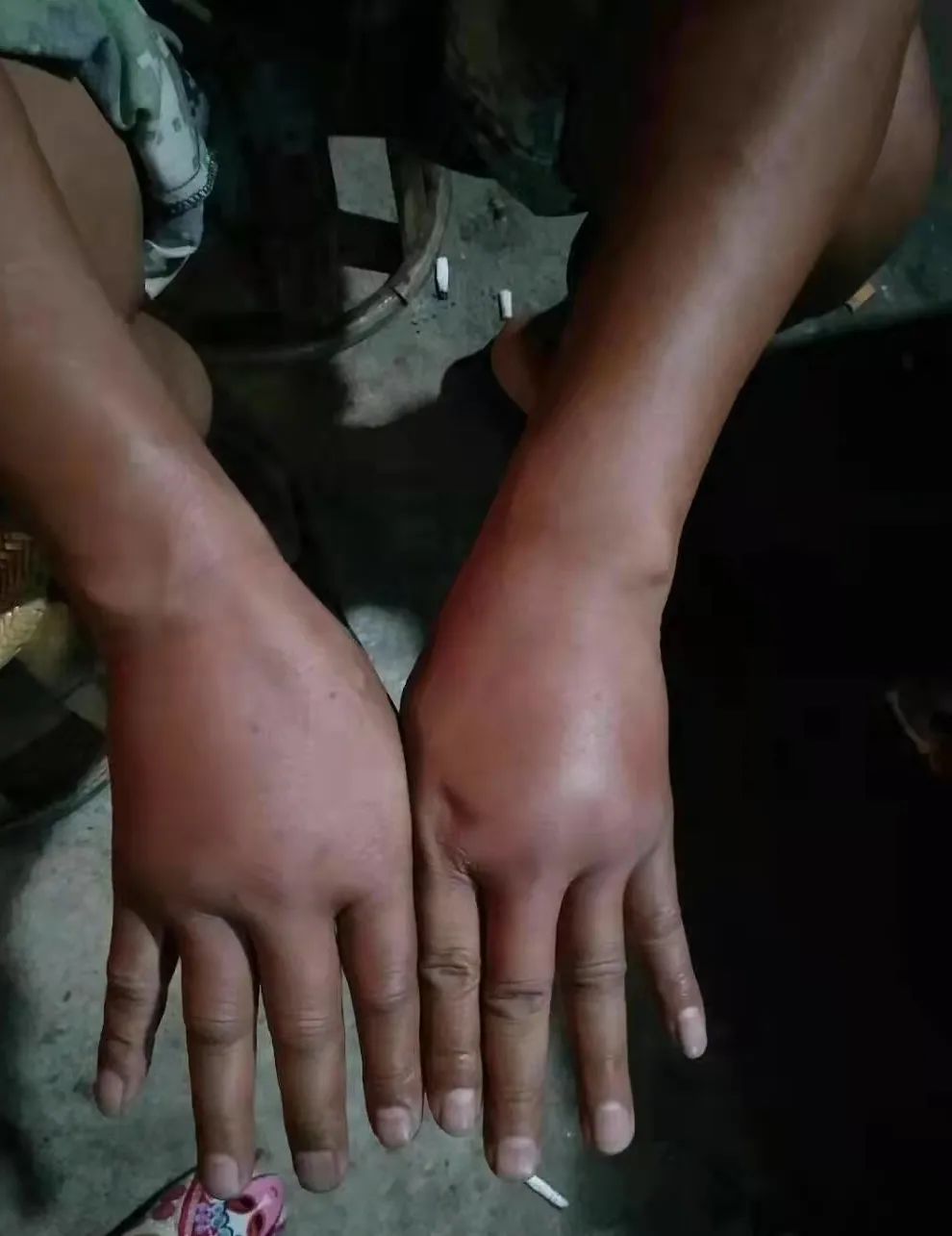 思茅区人民医院