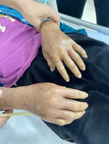 思茅区人民医院