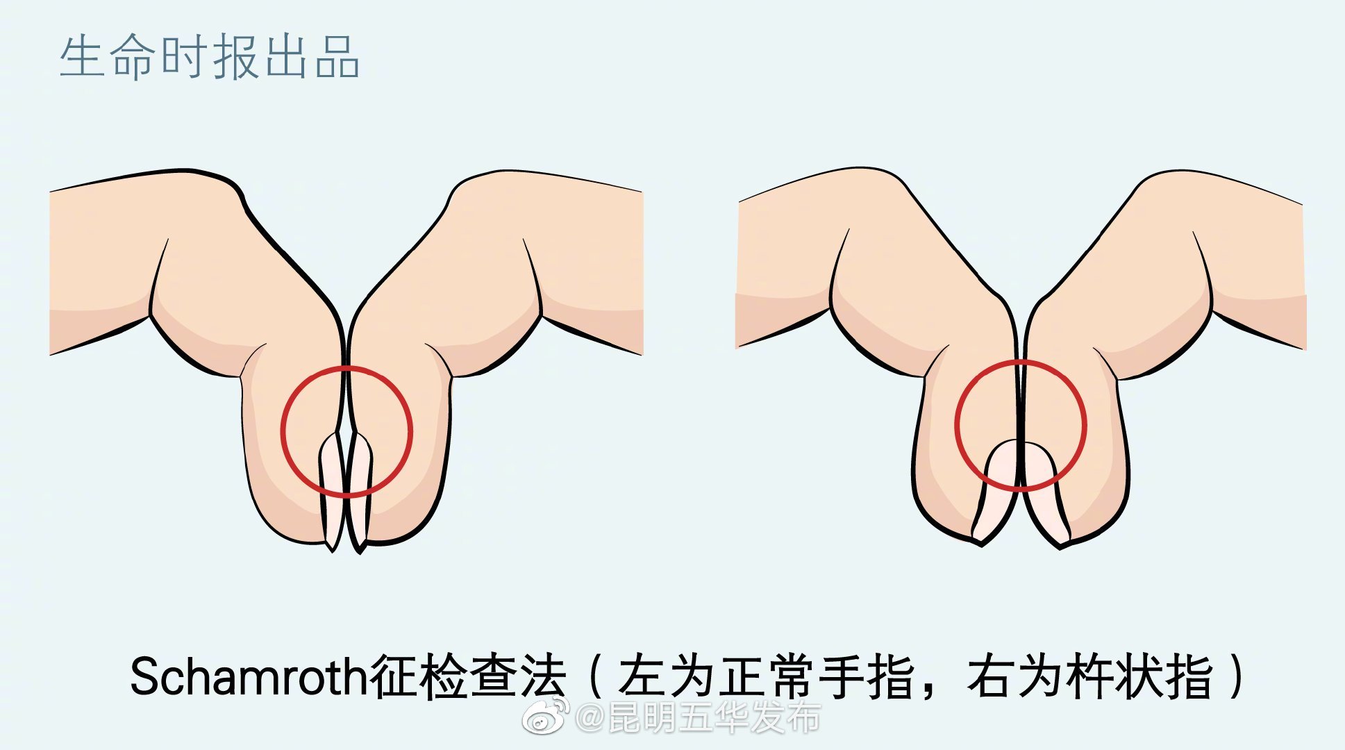 “昆明五华发布”微博