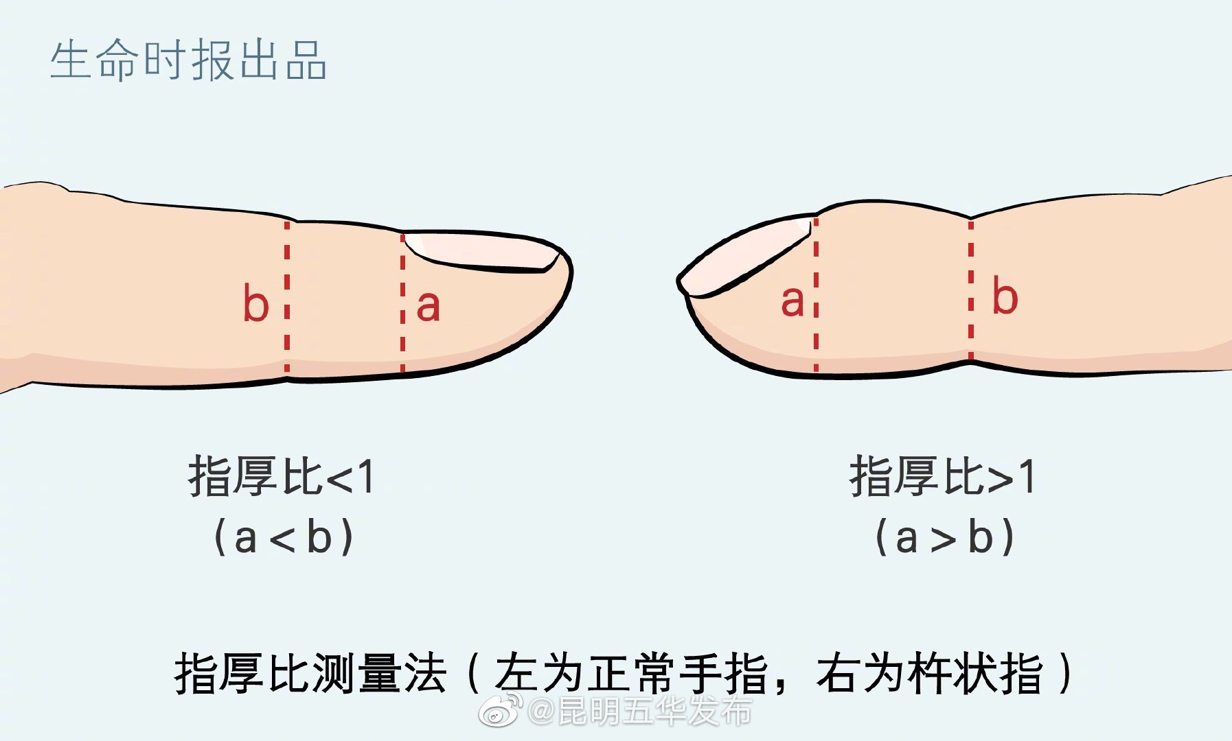 “昆明五华发布”微博