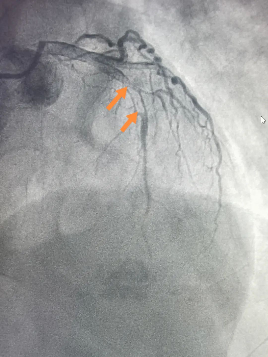 普洱市人民医院