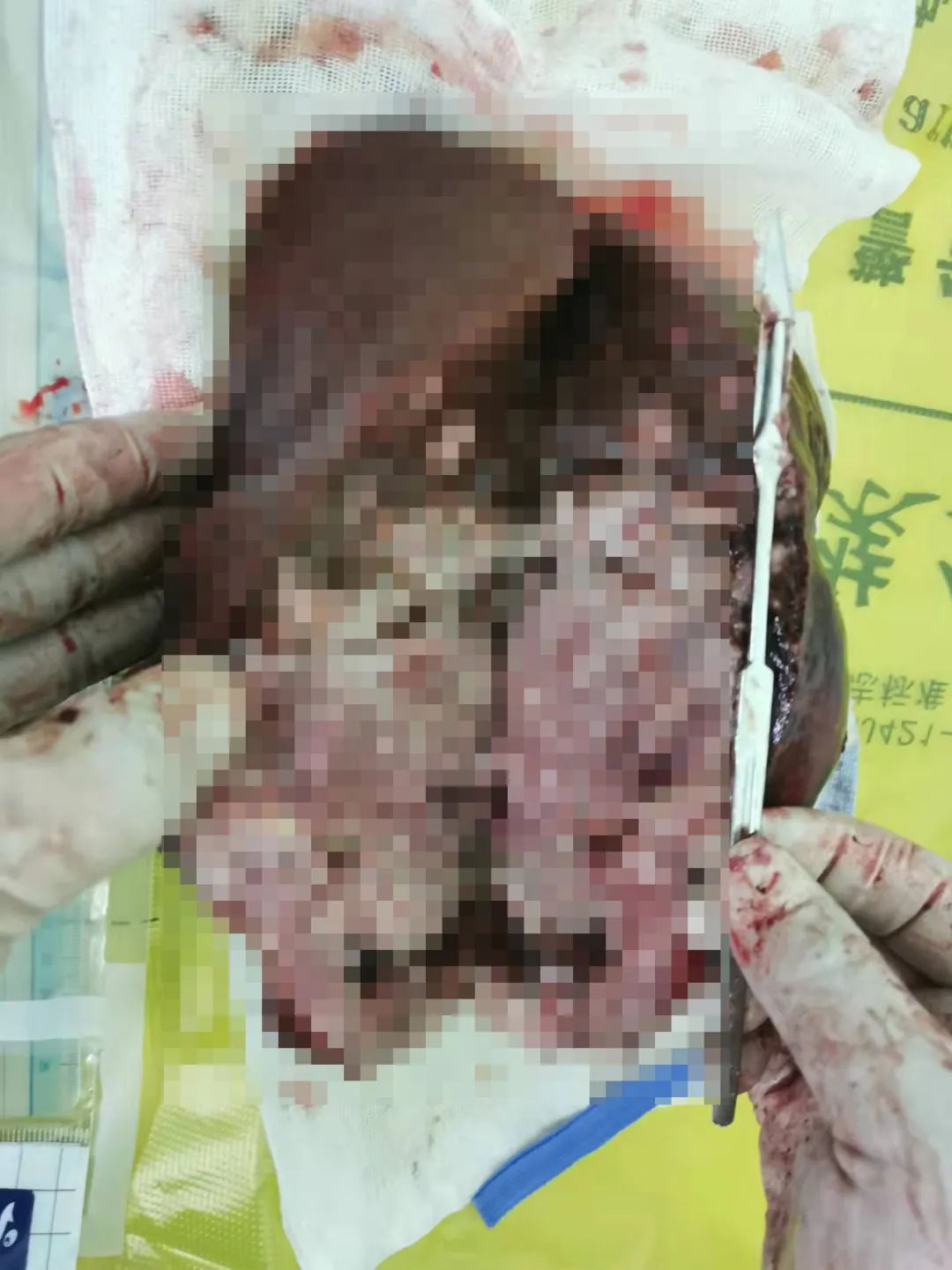 普洱市人民医院